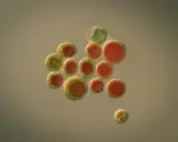 Mikroskopisk bild av Haematococcus pluvialis-alger, rika på astaxantin. Forskning på dessa alger kan leda till nya hälsofördelar.