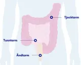 Illustration av tunntarmen, tjocktarmen och ändtarmen. Viktig för att förstå tunntarmen sjukdomar.