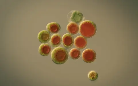 Mikroskopisk bild av Haematococcus pluvialis-alger, rika på astaxantin. Forskning på dessa alger kan leda till nya hälsofördelar.