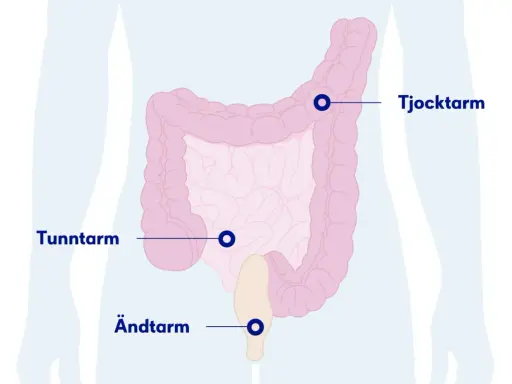 Illustration av tunntarmen, tjocktarmen och ändtarmen. Viktig för att förstå tunntarmen sjukdomar.