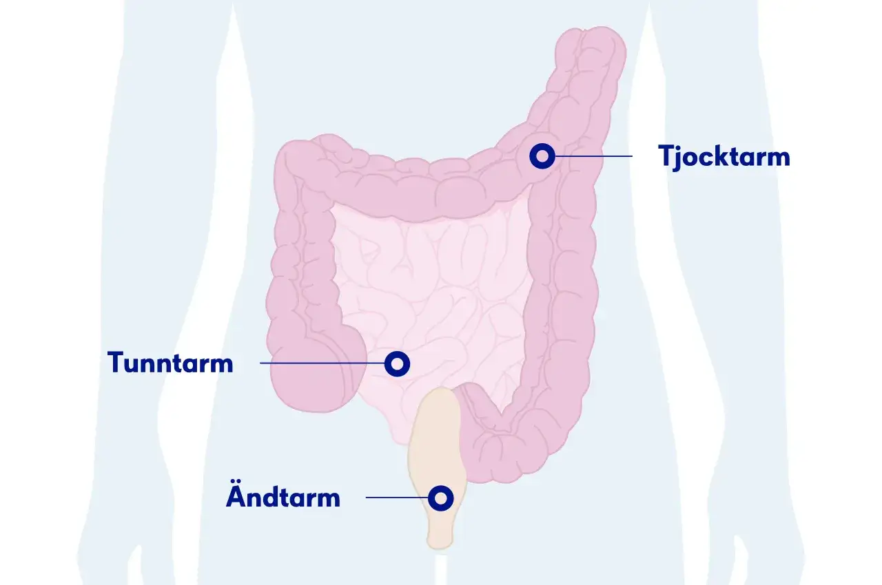 Illustration av tunntarm, tjocktarm och &auml;ndtarm. Kan vara relaterat till illam&aring;ende som kommer och g&aring;r.