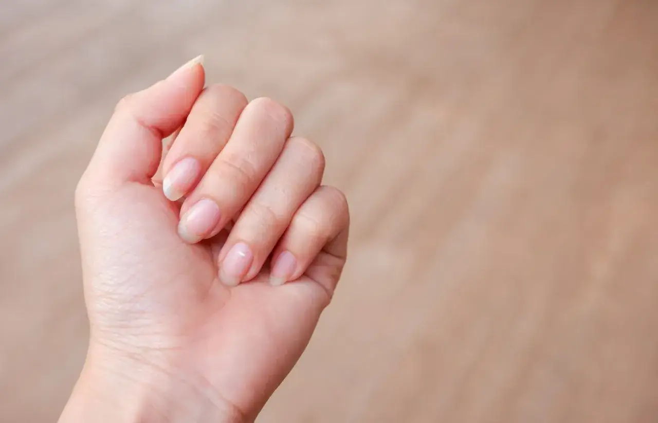 En hand med naglar som kan visa zink brist symptom, som vita fl&auml;ckar eller sk&ouml;ra naglar.