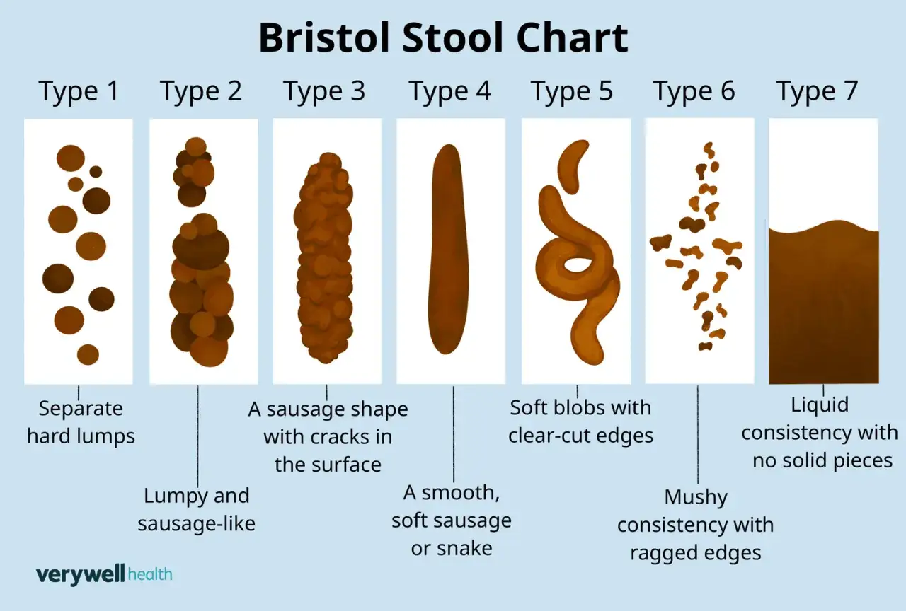 Bristol Stool Chart visar 7 typer av avföring, från hårda klumpar till kletigt bajs och flytande.